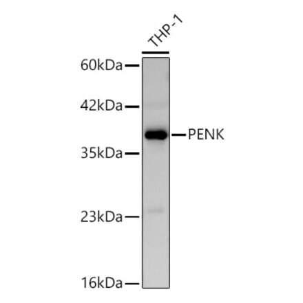 Western Blot - Anti-Met Enkephalin Antibody (A329599) - Antibodies.com