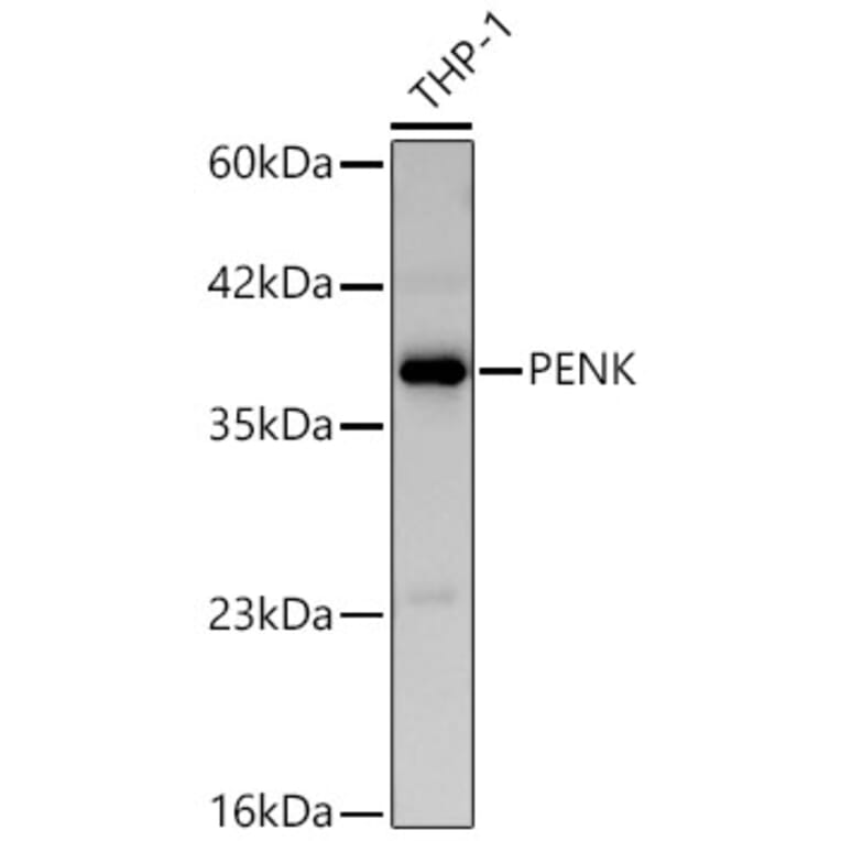Western Blot - Anti-Met Enkephalin Antibody (A329599) - Antibodies.com