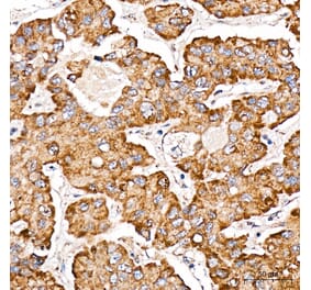 Immunohistochemistry - Anti-METTL4 Antibody (A329600) - Antibodies.com