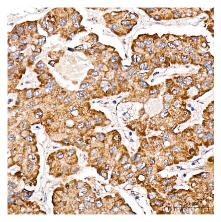 Immunohistochemistry - Anti-METTL4 Antibody (A329600) - Antibodies.com
