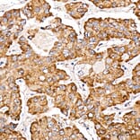 Immunohistochemistry - Anti-METTL4 Antibody (A329600) - Antibodies.com