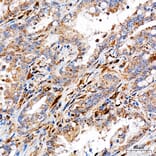 Immunohistochemistry - Anti-METTL4 Antibody (A329600) - Antibodies.com