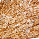Immunohistochemistry - Anti-METTL4 Antibody (A329600) - Antibodies.com