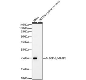 Western Blot - Anti-MFAP5 Antibody [ARC61067] (A329602) - Antibodies.com