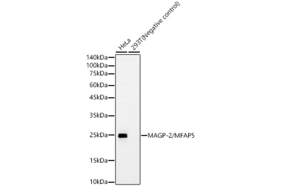 Western Blot - Anti-MFAP5 Antibody [ARC61067] (A329602) - Antibodies.com