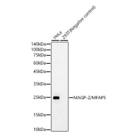 Western Blot - Anti-MFAP5 Antibody [ARC61067] (A329602) - Antibodies.com