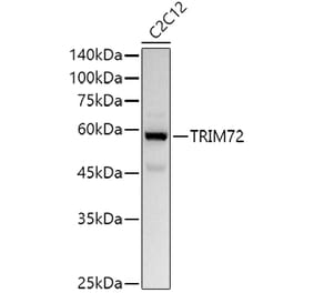 Western Blot - Anti-MG53 Antibody (A329603) - Antibodies.com