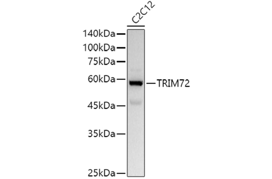 Western Blot - Anti-MG53 Antibody (A329603) - Antibodies.com