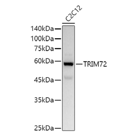 Western Blot - Anti-MG53 Antibody (A329603) - Antibodies.com