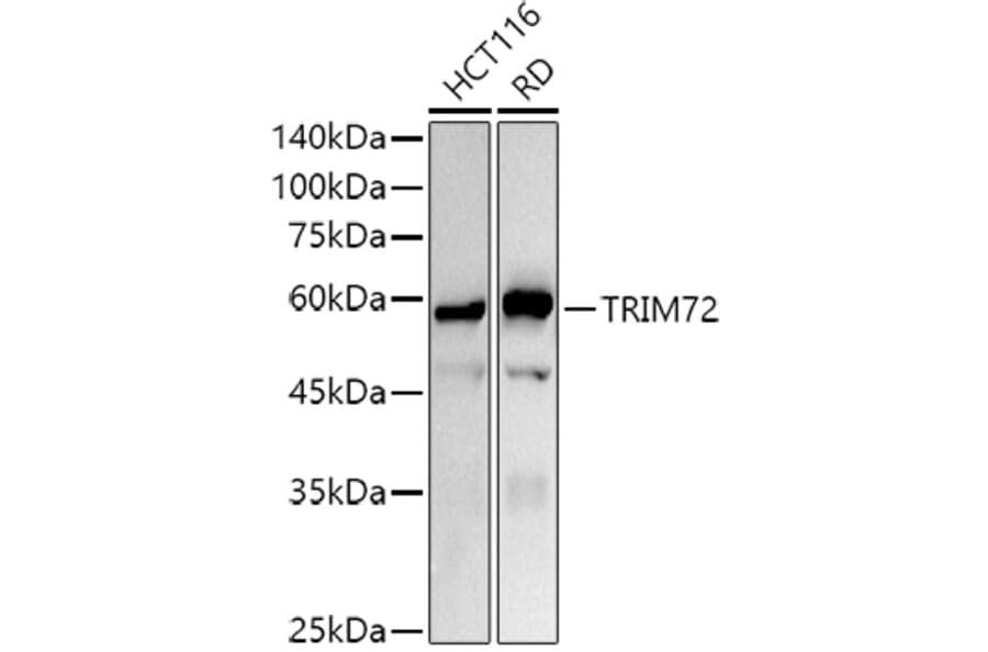 Western Blot - Anti-MG53 Antibody (A329603) - Antibodies.com
