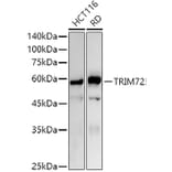 Western Blot - Anti-MG53 Antibody (A329603) - Antibodies.com
