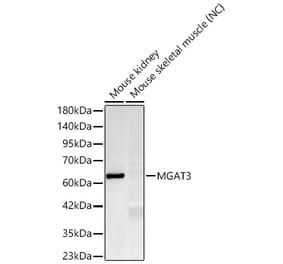 Western Blot - Anti-MGAT3 Antibody [ARC60778] (A329604) - Antibodies.com