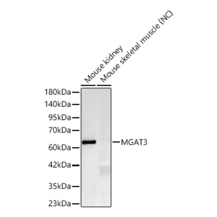 Western Blot - Anti-MGAT3 Antibody [ARC60778] (A329604) - Antibodies.com