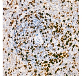 Immunohistochemistry - Anti-Mki67 Antibody (A329605) - Antibodies.com