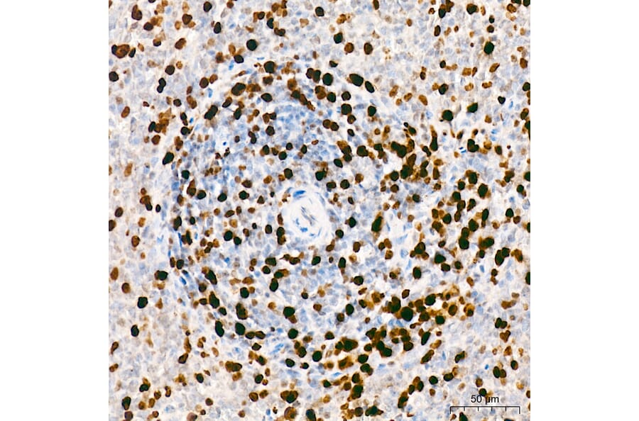 Immunohistochemistry - Anti-Mki67 Antibody (A329605) - Antibodies.com