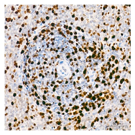 Immunohistochemistry - Anti-Mki67 Antibody (A329605) - Antibodies.com