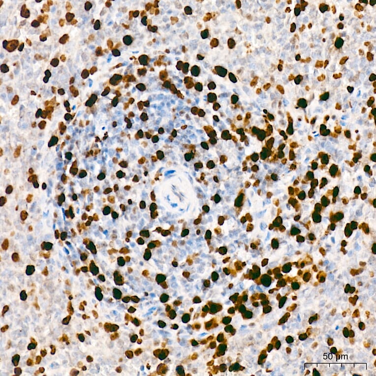 Immunohistochemistry - Anti-Mki67 Antibody (A329605) - Antibodies.com