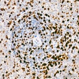 Immunohistochemistry - Anti-Mki67 Antibody (A329605) - Antibodies.com