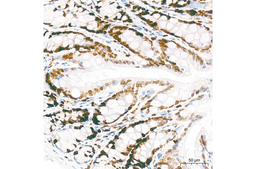 Immunohistochemistry - Anti-Mki67 Antibody (A329605) - Antibodies.com