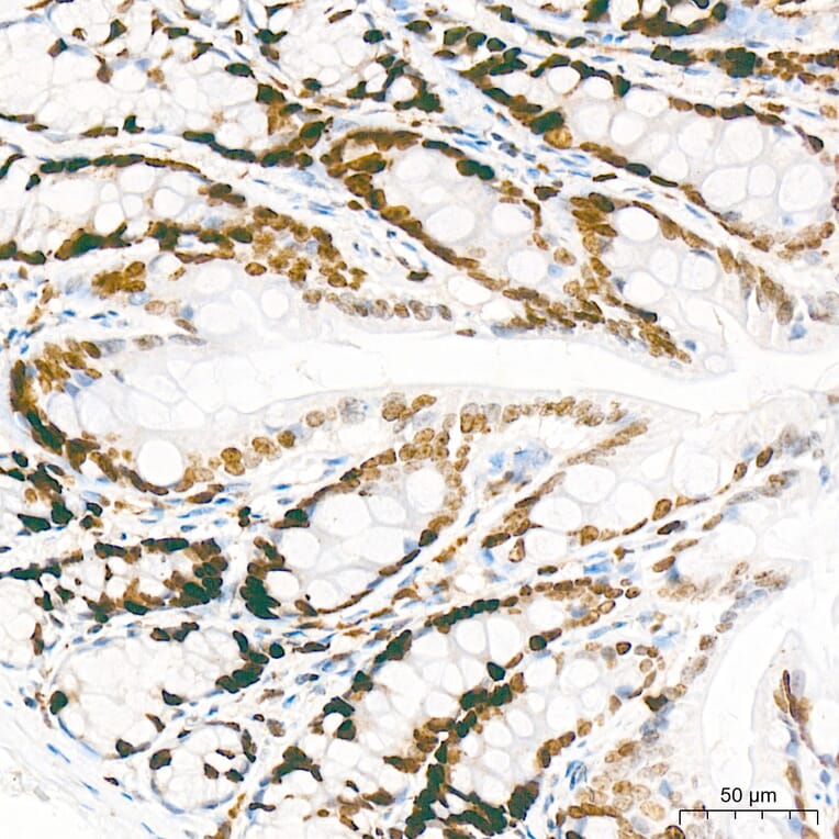 Immunohistochemistry - Anti-Mki67 Antibody (A329605) - Antibodies.com
