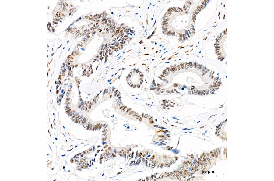 Immunohistochemistry - Anti-Mki67 Antibody (A329605) - Antibodies.com