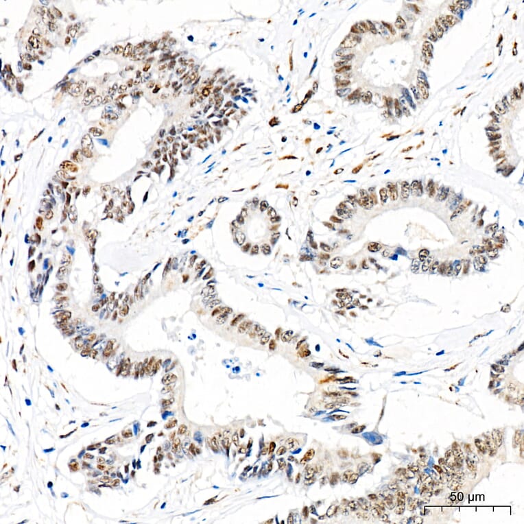 Immunohistochemistry - Anti-Mki67 Antibody (A329605) - Antibodies.com