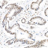 Immunohistochemistry - Anti-Mki67 Antibody (A329605) - Antibodies.com