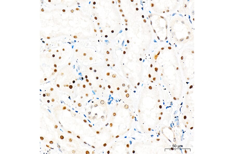 Immunohistochemistry - Anti-Mki67 Antibody (A329605) - Antibodies.com