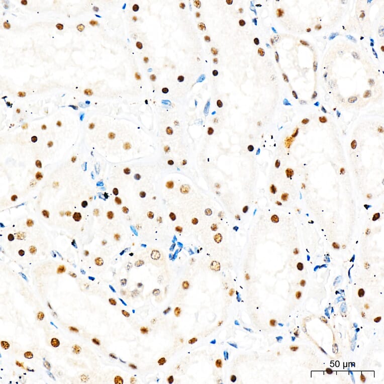 Immunohistochemistry - Anti-Mki67 Antibody (A329605) - Antibodies.com