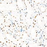 Immunohistochemistry - Anti-Mki67 Antibody (A329605) - Antibodies.com