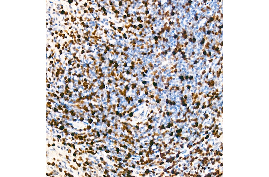 Immunohistochemistry - Anti-Mki67 Antibody (A329605) - Antibodies.com
