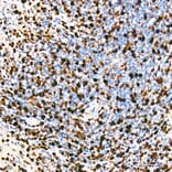 Immunohistochemistry - Anti-Mki67 Antibody (A329605) - Antibodies.com