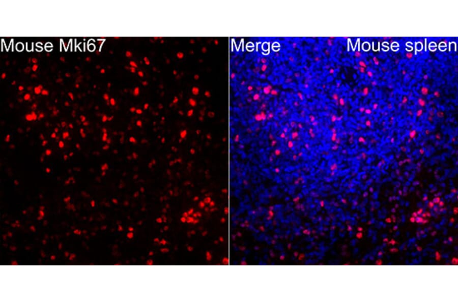 Immunofluorescence - Anti-Mki67 Antibody (A329605) - Antibodies.com
