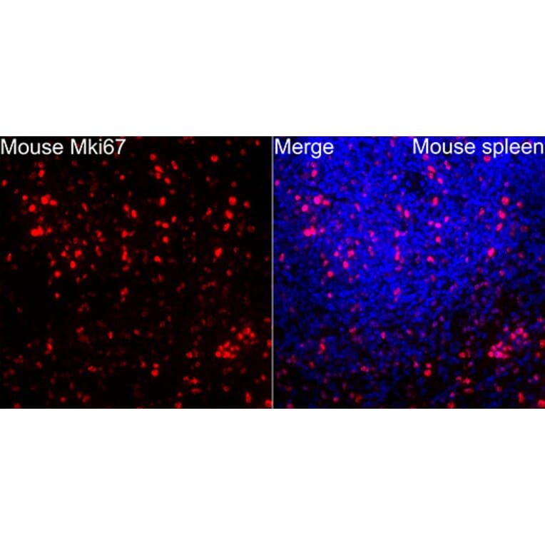 Immunofluorescence - Anti-Mki67 Antibody (A329605) - Antibodies.com