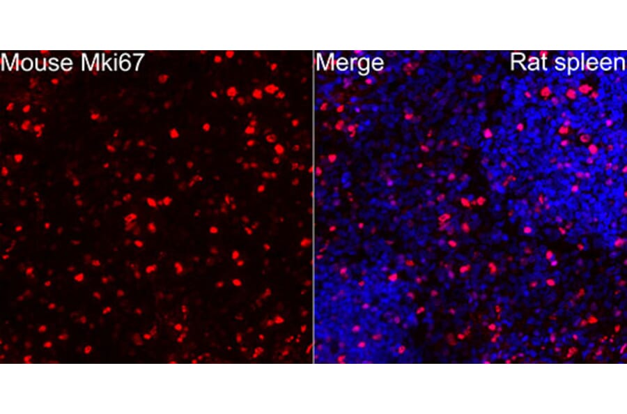 Immunofluorescence - Anti-Mki67 Antibody (A329605) - Antibodies.com