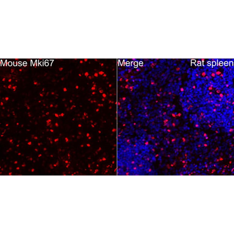 Immunofluorescence - Anti-Mki67 Antibody (A329605) - Antibodies.com