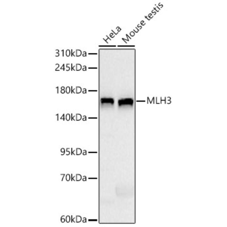Western Blot - Anti-MLH3 Antibody [ARC66686] (A329607) - Antibodies.com