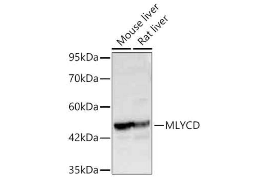Western Blot - Anti-MLYCD Antibody (A329608) - Antibodies.com