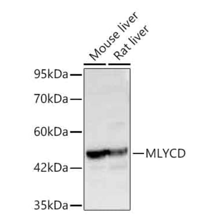 Western Blot - Anti-MLYCD Antibody (A329608) - Antibodies.com