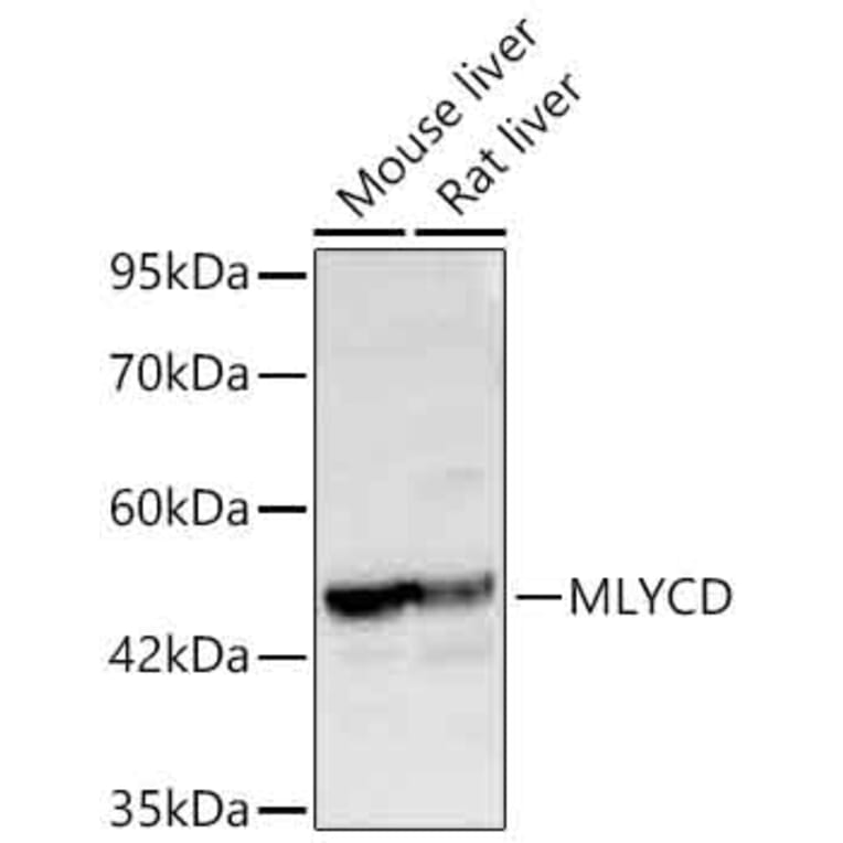 Western Blot - Anti-MLYCD Antibody (A329608) - Antibodies.com