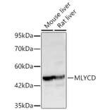 Western Blot - Anti-MLYCD Antibody (A329608) - Antibodies.com