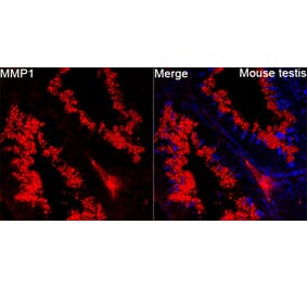 Immunofluorescence - Anti-MMP1 Antibody (A329609) - Antibodies.com