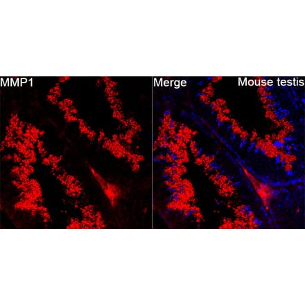 Immunofluorescence - Anti-MMP1 Antibody (A329609) - Antibodies.com