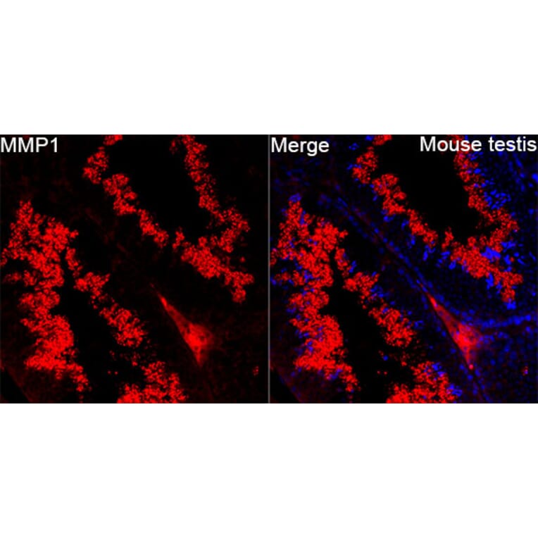 Immunofluorescence - Anti-MMP1 Antibody (A329609) - Antibodies.com