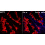 Immunofluorescence - Anti-MMP1 Antibody (A329609) - Antibodies.com