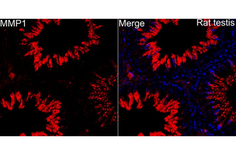 Immunofluorescence - Anti-MMP1 Antibody (A329609) - Antibodies.com