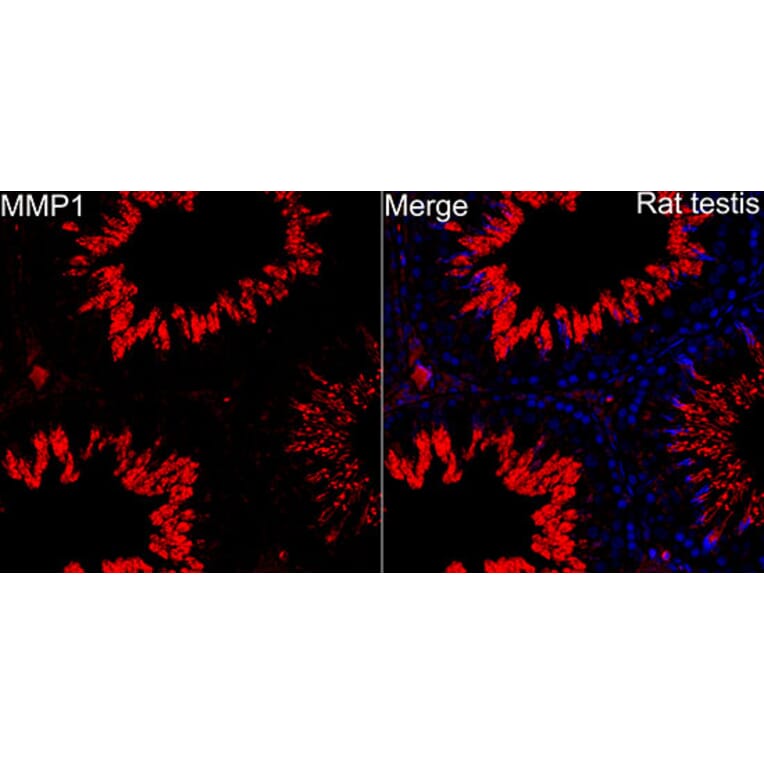 Immunofluorescence - Anti-MMP1 Antibody (A329609) - Antibodies.com