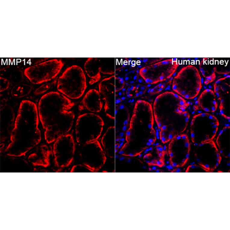 Immunofluorescence - Anti-MMP14 Antibody (A329610) - Antibodies.com
