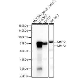 Western Blot - Anti-MMP2 Antibody [ARC57602] (A329611) - Antibodies.com