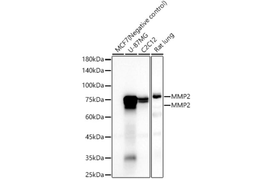 Western Blot - Anti-MMP2 Antibody [ARC57602] (A329611) - Antibodies.com